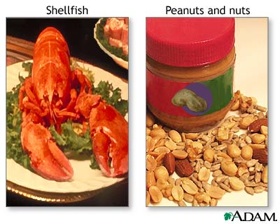 Food Allergens
